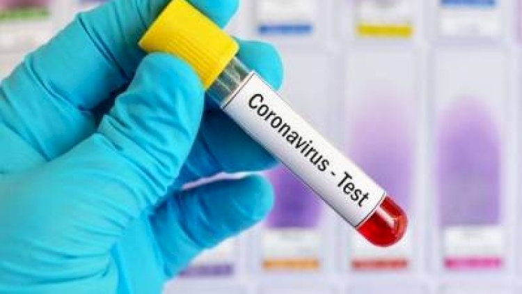 Ermənistanda koronavirus:  517 yeni yoluxma...