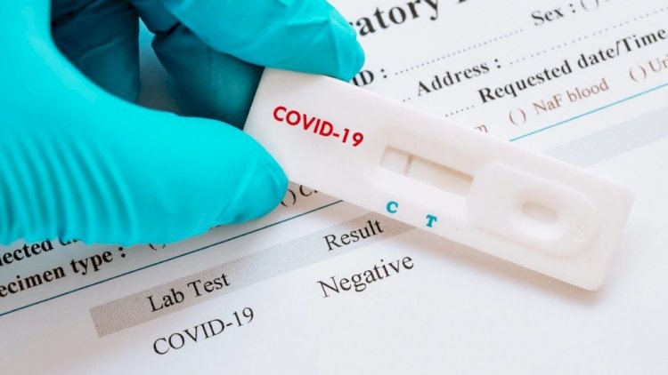 Koronavirus testlərinin cavabı niyə gecikir?