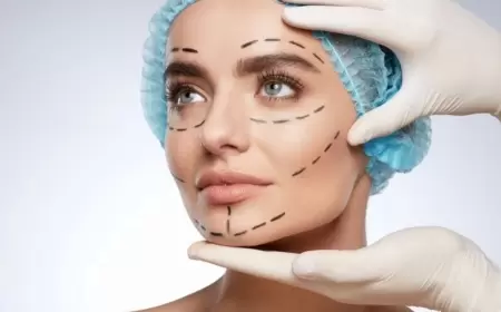 Estetik əməliyyatdan sonra vəsiqə və pasportlar dəyişdirilməlidir? - "Kaspi"nin ARAŞDIRMASI